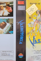 Vasectomy: A Delicate Matter